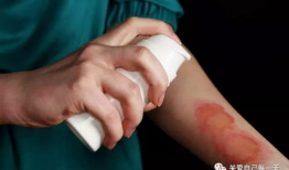 被烫伤敢吃凉瓜吗图片,敢挑战凉瓜的清凉滋味吗？