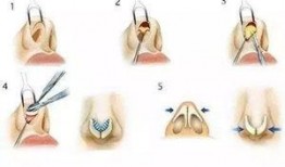 吃瓜鼻子变形,揭秘奇特现象背后的科学奥秘